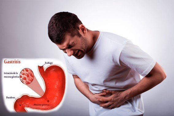 ¿Qué Emociones Provocan La Gastritis?